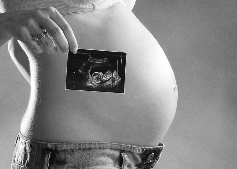 babybauch-fotografie